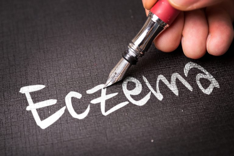 Eczema