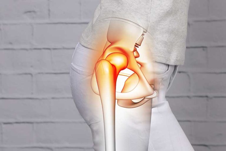Woman suffering from hip joint pain