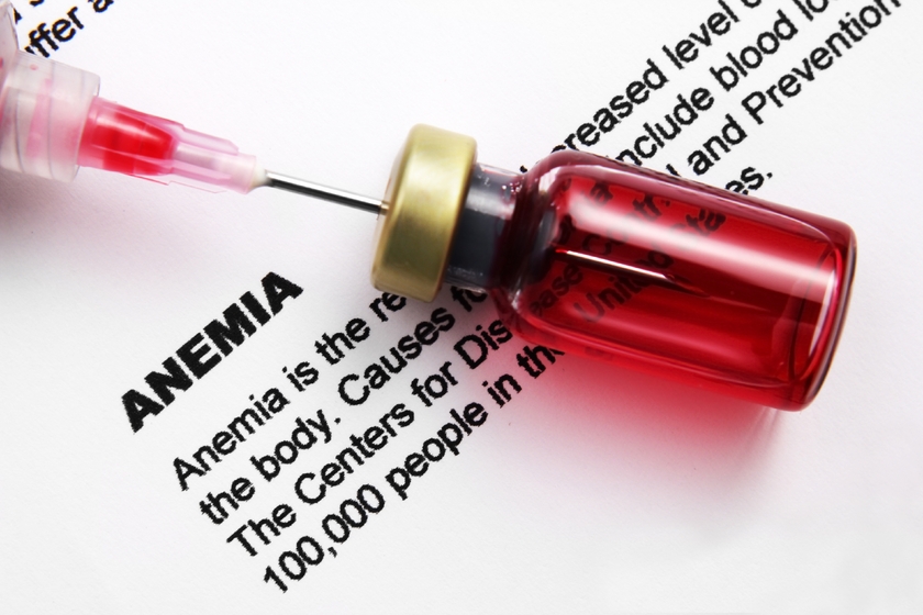 Anemia Anemia