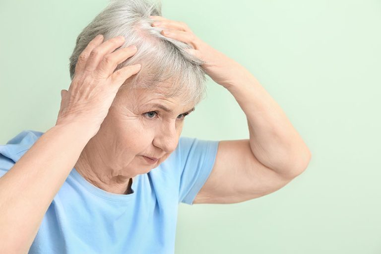 Senior woman with hair loss problem