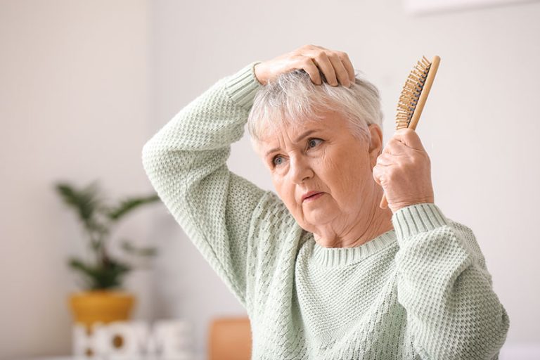 senior-woman-hair-loss-problem Senior woman with hair loss problem at home