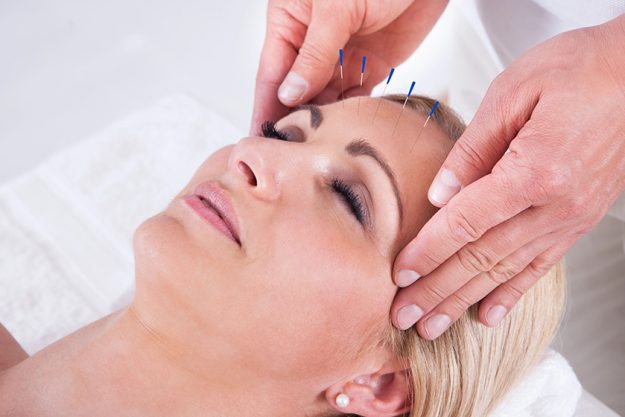 an acupuncture therapy in a spa center