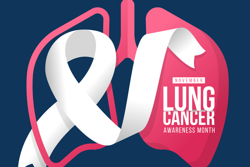 Raising Awareness About Lung Cancer On World Lung Cancer Day Debunking 5 Common Myths And Misconceptions