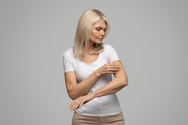 dermatitis eczema allergy psoriasis concept