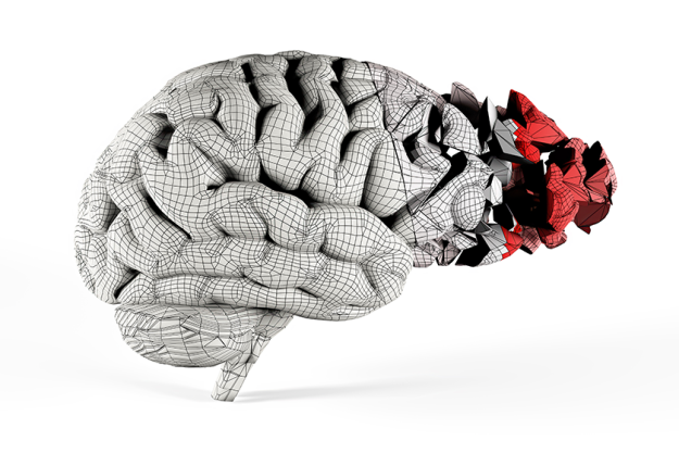 shattered brain covered mesh conceptual illustration shattered brain covered mesh conceptual illustration