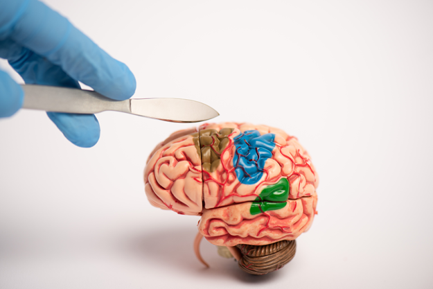 surgeon holding scalpel brain model