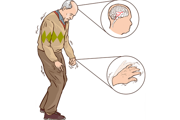 old man with parkinson symptoms